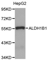 Western blot analysis of extracts of HepG2 cell line, using ALDH1B1 antibody.