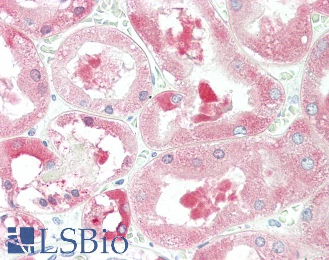 Anti-ALDH1L1 antibody IHC staining of human kidney. Immunohistochemistry of formalin-fixed, paraffin-embedded tissue after heat-induced antigen retrieval. Antibody LS-B10382 concentration 10 ug/ml.