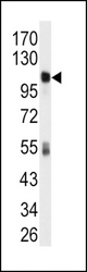 Western blot of anti-ALDH1L1 Antibody in mouse liver tissue lysates (35 ug/lane). ALDH1L1(arrow) was detected using the purified antibody.