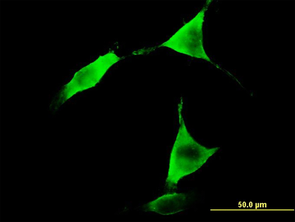 Immunofluorescence of monoclonal antibody to ALDH1L1 on NIH/3T3 cell. [antibody concentration 10 ug/ml]