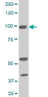 Western blot of ALDH1L1 expression in NIH/3T3 cells with ALDH1L1 monoclonal antibody, clone 3E9.
