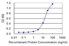 Detection limit for recombinant GST tagged ALDH1L1 is 0.3 ng/ml as a capture antibody.