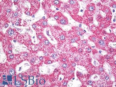 Anti-ALDH2 antibody IHC of human liver. Immunohistochemistry of formalin-fixed, paraffin-embedded tissue after heat-induced antigen retrieval. Antibody LS-B7924 dilution 10 ug/ml.