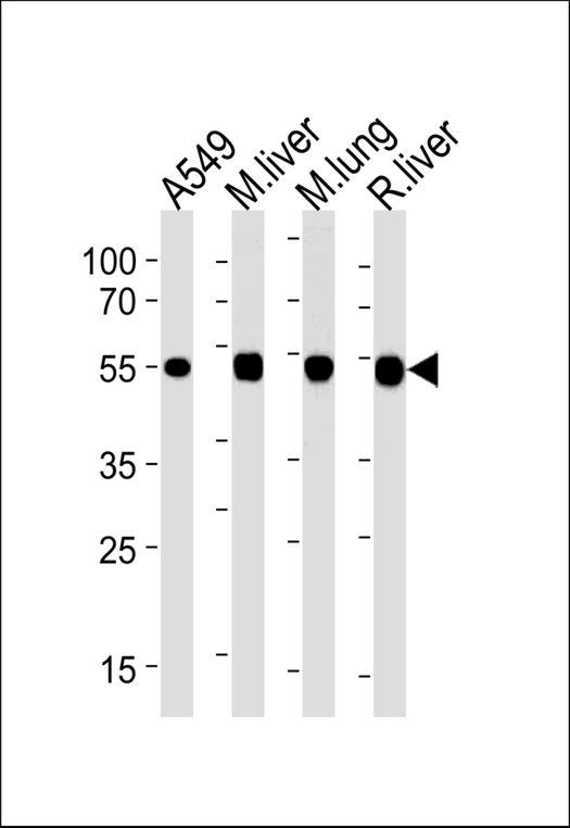 ALDH2 Antibody western blot of A549 cell line,mouse liver and lung,rat liver lysates (35 ug/lane). The ALDH2 antibody detected the ALDH2 protein (arrow).
