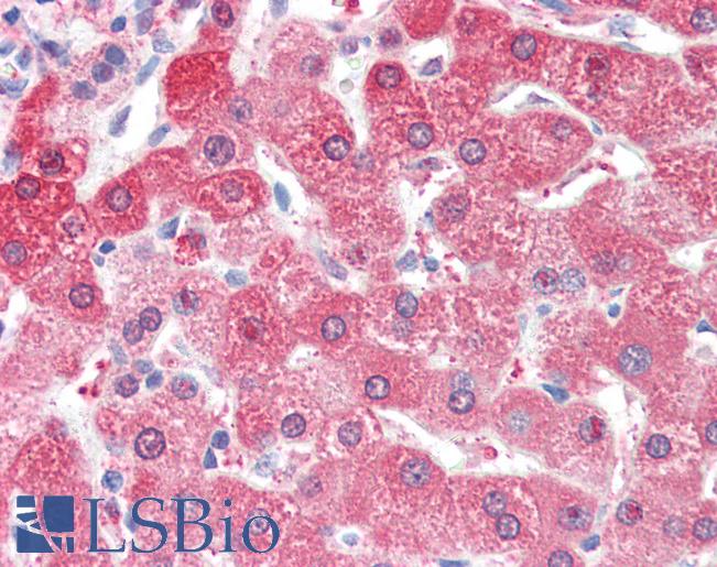 Anti-ALDH2 antibody IHC of human liver. Immunohistochemistry of formalin-fixed, paraffin-embedded tissue after heat-induced antigen retrieval. Antibody LS-B3390 concentration 10 ug/ml.