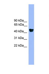 ALDH3A1 antibody LS-C135493 Western blot of Fetal Muscle lysate. Antibody concentration 1 ug/ml.
