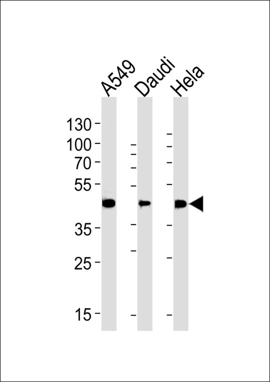 ALDH3A1 Antibody western blot of A549,Daudi,HeLa cell line lysates (35 ug/lane). The ALDH3A1 antibody detected the ALDH3A1 protein (arrow).