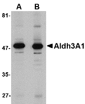 Western blot of Aldh3A1 in human stomach lysate with Aldh3A1 antibody at (A) 1 and (B) 2 ug/ml.