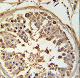 ABCF1 Antibody IHC of formalin-fixed and paraffin-embedded human testis tissue followed by peroxidase-conjugated secondary antibody and DAB staining.