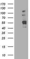 HEK293T cells were transfected with the pCMV6-ENTRY control (Left lane) or pCMV6-ENTRY ALDH3A2 (Right lane) cDNA for 48 hrs and lysed. Equivalent amounts of cell lysates (5 ug per lane) were separated by SDS-PAGE and immunoblotted with anti-ALDH3A2.