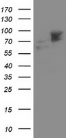 HEK293T cells were transfected with the pCMV6-ENTRY control (Left lane) or pCMV6-ENTRY ALDH3A2 (Right lane) cDNA for 48 hrs and lysed. Equivalent amounts of cell lysates (5 ug per lane) were separated by SDS-PAGE and immunoblotted with anti-ALDH3A2.