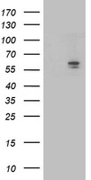 HEK293T cells were transfected with the pCMV6-ENTRY control (Left lane) or pCMV6-ENTRY ALDH3A2 (Right lane) cDNA for 48 hrs and lysed. Equivalent amounts of cell lysates (5 ug per lane) were separated by SDS-PAGE and immunoblotted with anti-ALDH3A2.