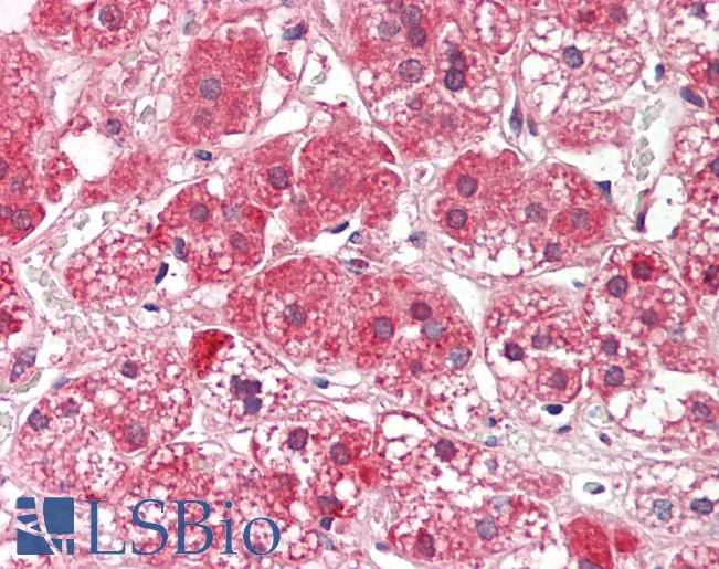 Human Adrenal: Formalin-Fixed, Paraffin-Embedded (FFPE)