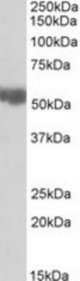 ALDH3A2 antibody (0.03 ug/ml) staining of Rat Liver lysate (35 ug protein/ml in RIPA buffer). Primary incubation was 1 hour. Detected by chemiluminescence.