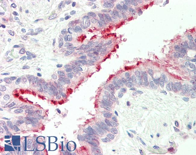 Human, Lung: Formalin-Fixed Paraffin-Embedded (FFPE)