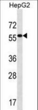 ALDH3B2 Antibody western blot of HepG2 cell line lysates (35 ug/lane). The ALDH3B2 antibody detected the ALDH3B2 protein (arrow).