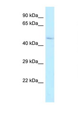 ALDH3B2 antibody LS-C145951 Western blot of Fetal Lung lysate. Antibody concentration 1 ug/ml.