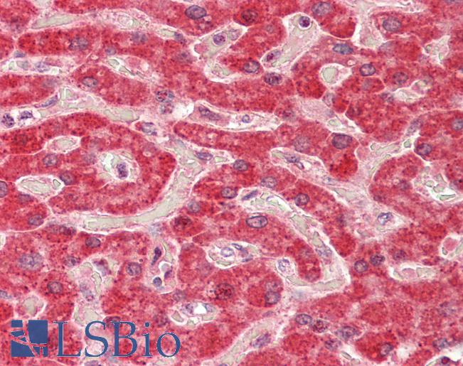 Anti-ALDH5A1 antibody IHC staining of human liver. Immunohistochemistry of formalin-fixed, paraffin-embedded tissue after heat-induced antigen retrieval. Antibody LS-B11178 concentration 5 ug/ml.
