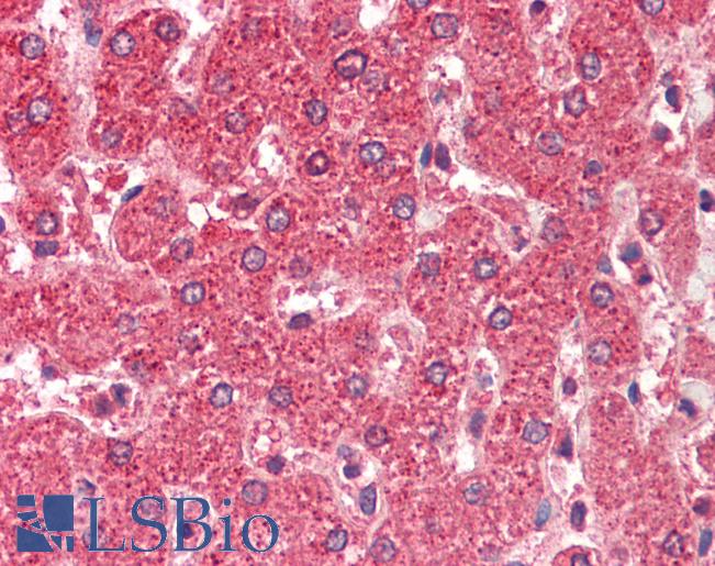 Anti-ALDH5A1 antibody IHC staining of human liver. Immunohistochemistry of formalin-fixed, paraffin-embedded tissue after heat-induced antigen retrieval. Antibody LS-B9530 concentration 5 ug/ml.