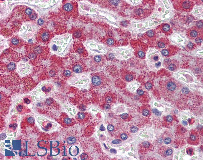 Anti-ALDH5A1 antibody IHC of human liver. Immunohistochemistry of formalin-fixed, paraffin-embedded tissue after heat-induced antigen retrieval. Antibody LS-B4165 concentration 5 ug/ml.