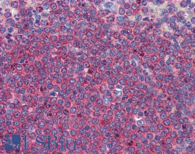Anti-ALDH5A1 antibody IHC of human spleen. Immunohistochemistry of formalin-fixed, paraffin-embedded tissue after heat-induced antigen retrieval. Antibody LS-B4165 concentration 5 ug/ml.