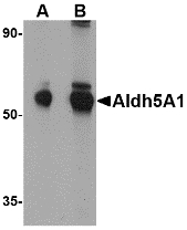 Western blot of Aldh5A1 in mouse liver lysate with Aldh5A1 antibody at (A) 1 and (B) 2 ug/ml.