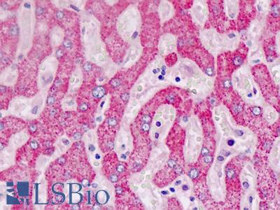 Human Liver: Formalin-Fixed, Paraffin-Embedded (FFPE)