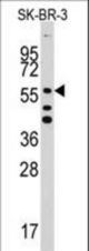 Western blot of ALDH5A1 Antibody in SK-BR-3 cell line lysates (35 ug/lane). ALDH5A1(arrow) was detected using the purified antibody.