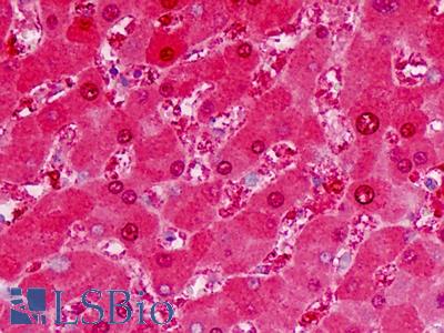 Human Liver: Formalin-Fixed, Paraffin-Embedded (FFPE)