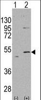 Western blot of ALDH5A1 (arrow) using rabbit polyclonal ALDH5A1 Antibody. 293 cell lysates (2 ug/lane) either nontransfected (Lane 1) or transiently transfected with the ALDH5A1 gene (Lane 2) (Origene Technologies).