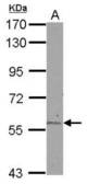 Sample (30 ug of whole cell lysate) A: Jurkat 7.5% SDS PAGE ALDH6A1 antibody diluted at 1:1000