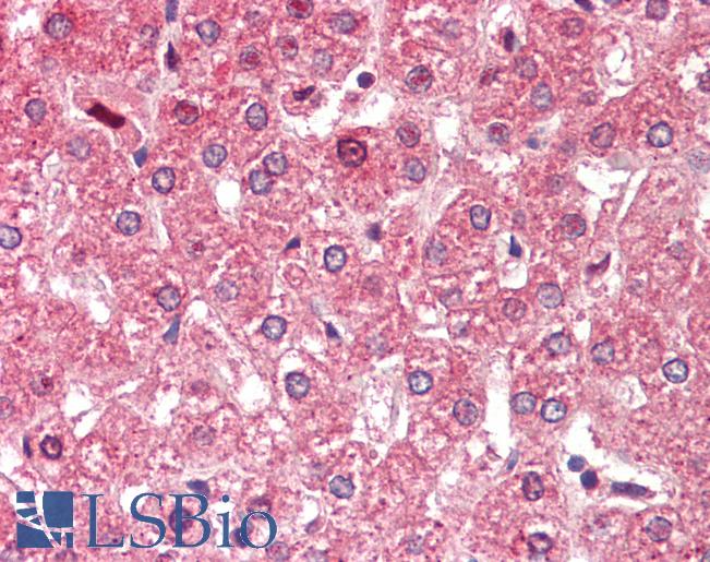Anti-ALDH6A1 antibody IHC staining of human liver. Immunohistochemistry of formalin-fixed, paraffin-embedded tissue after heat-induced antigen retrieval. Antibody LS-B9531 concentration 5 ug/ml.