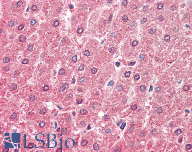 Anti-ALDH6A1 antibody IHC staining of human liver. Immunohistochemistry of formalin-fixed, paraffin-embedded tissue after heat-induced antigen retrieval. Antibody LS-B9532 concentration 5 ug/ml.