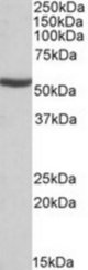 ALDH6A1 antibody (0.1 ug/ml) staining of Mouse Kidney lysate (35 ug protein/ml in RIPA buffer). Primary incubation was 1 hour. Detected by chemiluminescence.