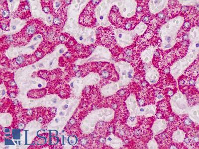 Human Liver: Formalin-Fixed, Paraffin-Embedded (FFPE)