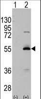 Western blot of ALDH6A1 (arrow) using rabbit polyclonal ALDH6A1 Antibody (RB11957). 293 cell lysates (2 ug/lane) either nontransfected (Lane 1) or transiently transfected with the ALDH6A1 gene (Lane 2) (Origene Technologies).
