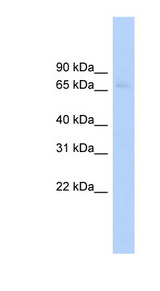 ABCF2 antibody LS-C116238 Western blot of HepG2 cell lysate.