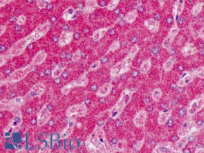Human Liver: Formalin-Fixed, Paraffin-Embedded (FFPE)