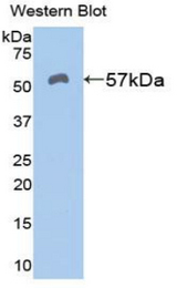 Western blot of recombinant ALDH7A1.