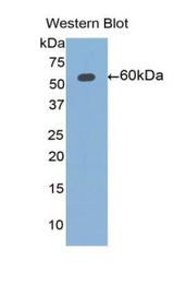 Western blot of recombinant ALDH7A1.