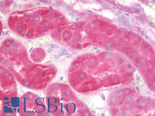 Anti-ALDH7A1 antibody IHC staining of human kidney. Immunohistochemistry of formalin-fixed, paraffin-embedded tissue after heat-induced antigen retrieval.