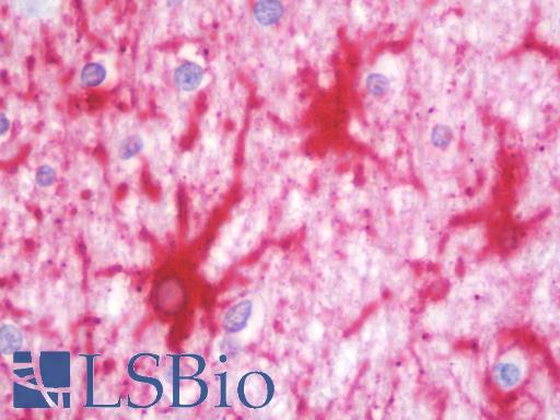 Anti-ALDH7A1 antibody IHC staining of human brain, cortex. Immunohistochemistry of formalin-fixed, paraffin-embedded tissue after heat-induced antigen retrieval. Antibody LS-B10225 dilution 1:50.