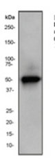 Western blot analysis on human liver lysate using anti-Aldh7a1 Rabbit Monoclonal.
