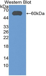 Western blot of recombinant ALDH7A1.
