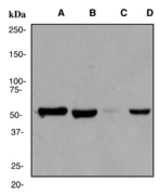 Western blot analysis on (A) HepG2 cell lysate (B) HeLa lysate (C) SW480 (D) SH-SY5Y using anti-Aldh7a1 antibody, dilution 1:10000.