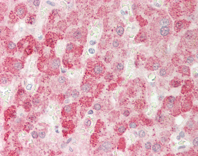Human Liver: Formalin-Fixed, Paraffin-Embedded (FFPE)