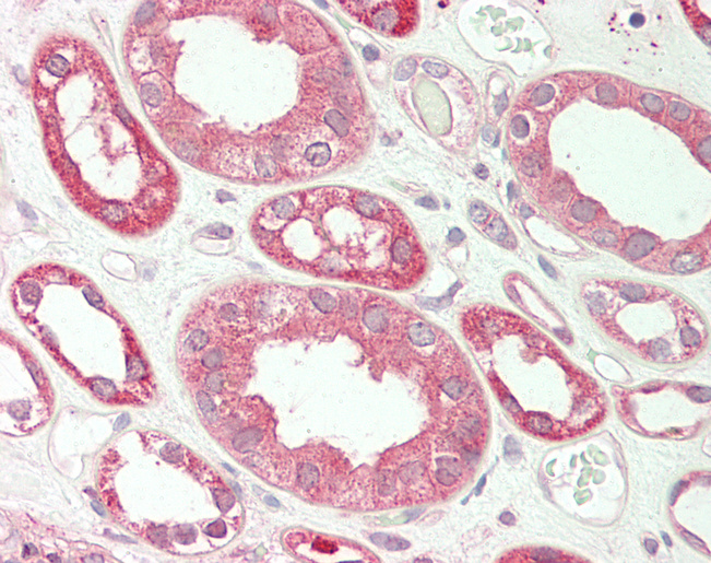 Human Kidney: Formalin-Fixed, Paraffin-Embedded (FFPE)