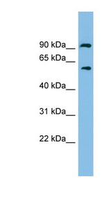 ALDH7A1 antibody LS-C116756 Western blot of Fetal Kidney lysate.