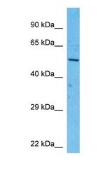 Western blot of AL9A1 Antibody with human ACHN Whole Cell lysate.