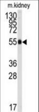 Western blot of anti-ALDH9A1 Antibody in mouse kidney tissue lysates (35 ug/lane). ALDH9A1(arrow) was detected using the purified antibody.
